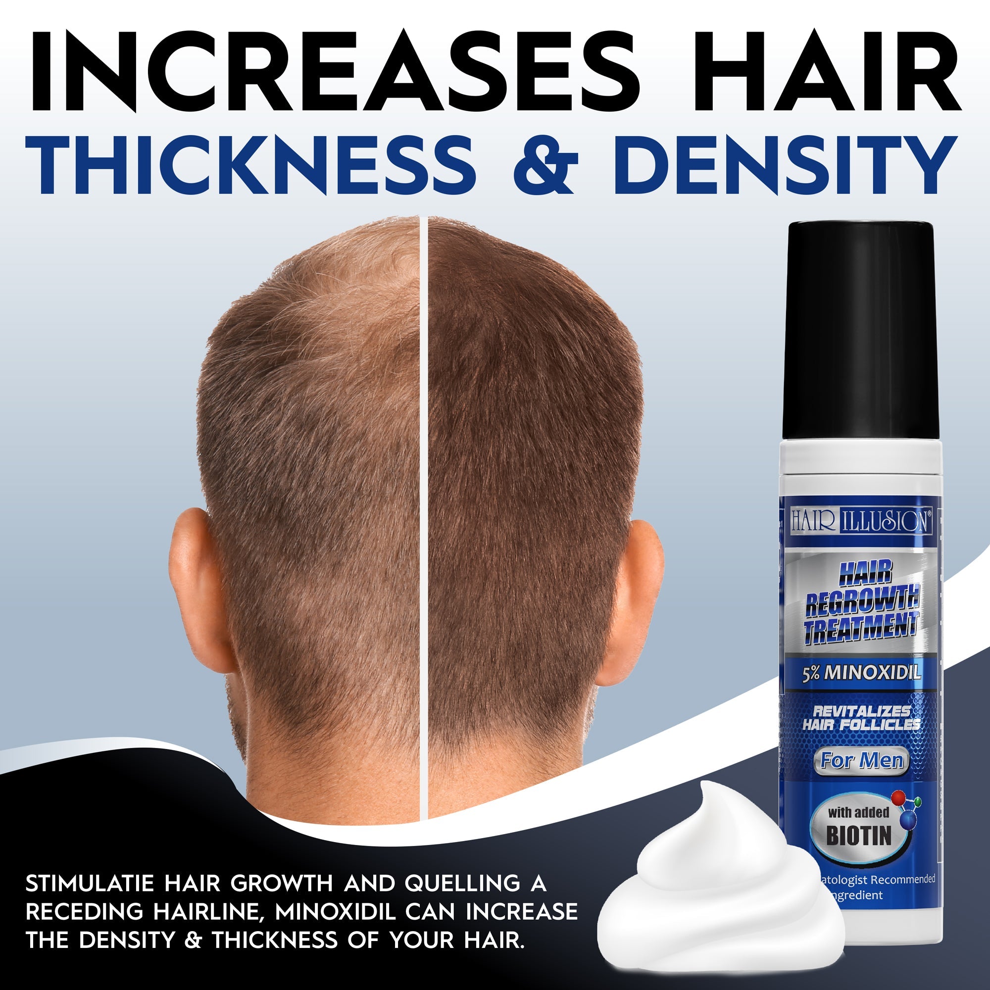Minoxidil (Rogaine) 5% Men's Hair Regrowth Foam (Pack of 3)